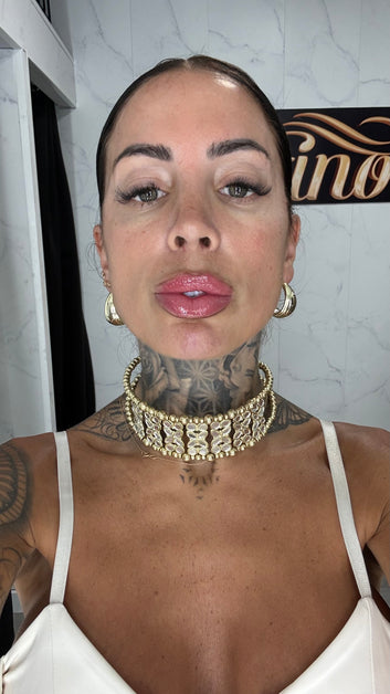 Collar